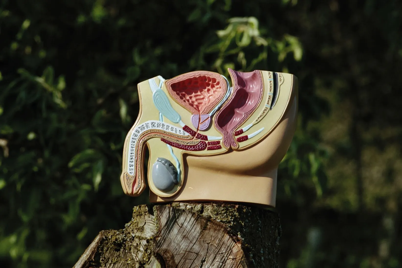 Anatomical model of the male pelvic organs on a tree stump against dark green foliage